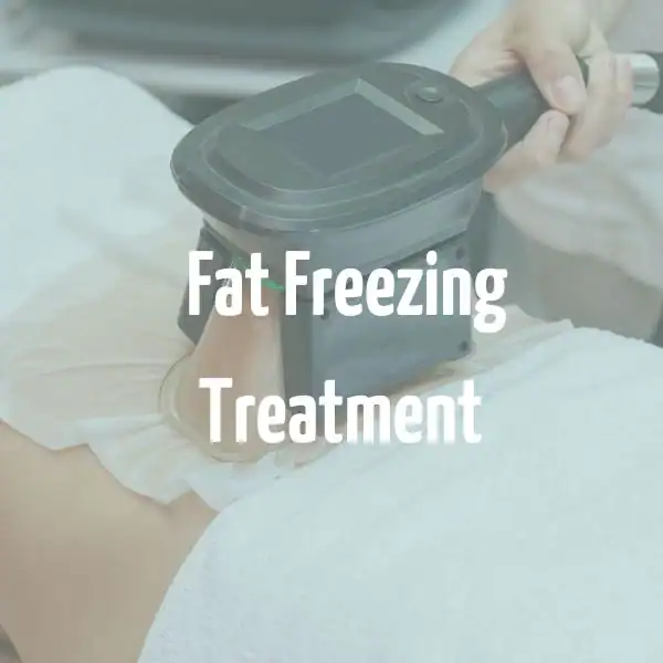 fat freezing treatment Leighton Buzzard