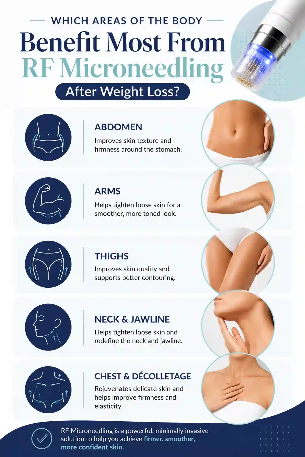 Which Areas of the Body Benefit Most From RF Microneedling After Weight Loss Leighton Buzzard